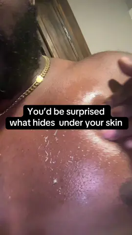 Unboxing the Dr.Melaxin Body & Face Peel Shot Duo! ✨ Watch as I test the Exfoliating Black Rice Ampoule and Turmeric Kojic Acid Spray—a powerful combo designed to brighten skin, fade dark spots, fight hyperpigmentation, and smooth rough patches. 🌿 If you’ve been searching for a kojic acid peel, turmeric exfoliator, or black rice brightening treatment, this duo is a must-try. Perfect for glowing skin, unclogging pores, evening skin tone, and boosting radiance—all in one set.