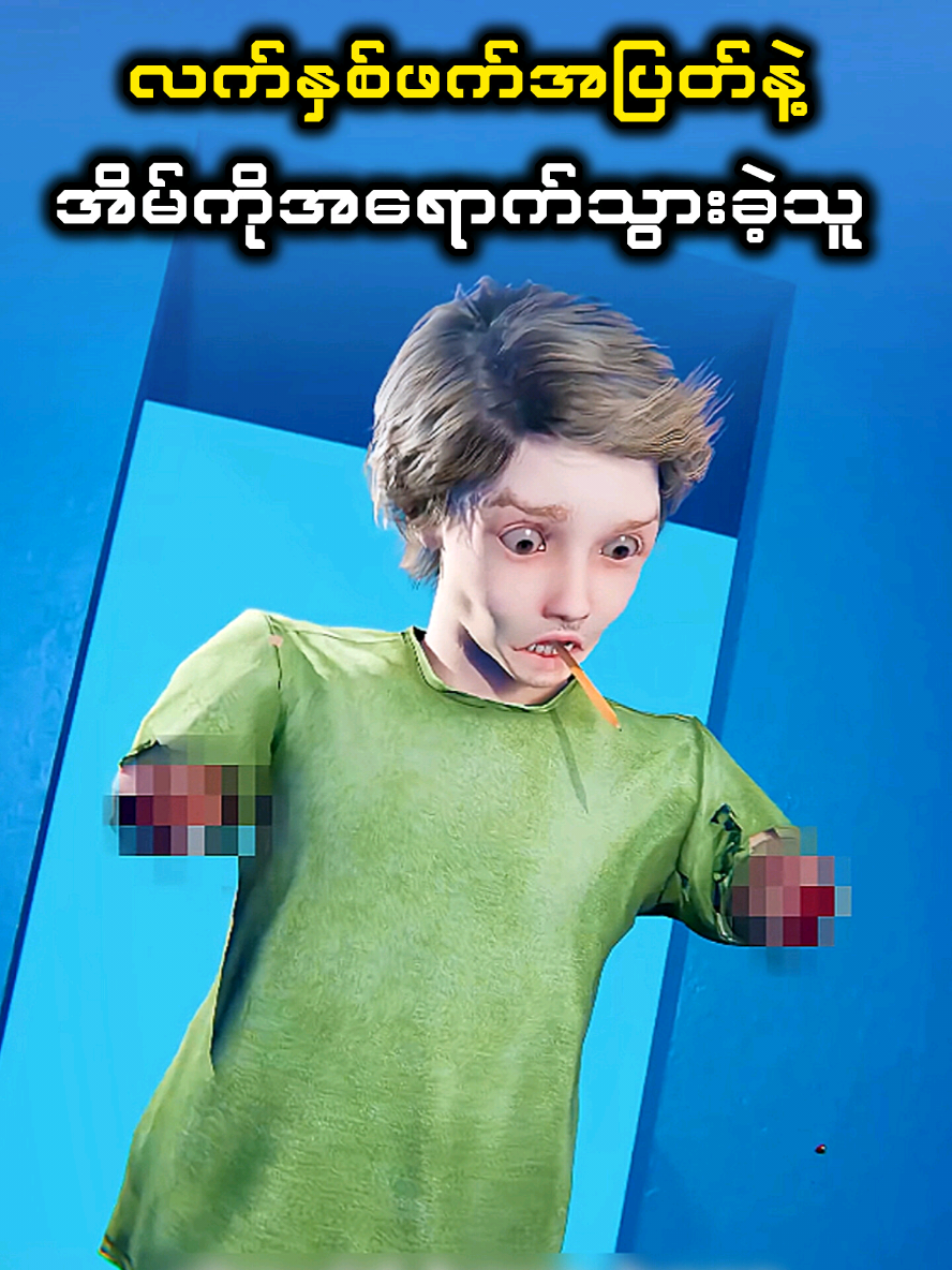 လက်နှစ်ဖက်ပြတ်သွားသည့်တိုင် အိမ်အပြန်လမ်းကို လျှောက်ခဲ့သူ 😱 #ဘာသာပြန်ဗီဒီယို 