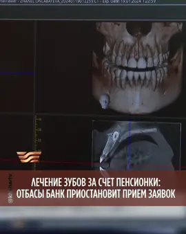 КАЗАХСТАНЦЫ НЕ СМОГУТ ИСПОЛЬЗОВАТЬ ПЕНСИОННЫЕ ИЗЛИШКИ НА СТОМАТОЛОГИЮ С 15 сентября 2025 года в Казахстане приостанавливают прием заявлений на использование пенсионных накоплений для оплаты стоматологических услуг. Подробнее ⤴️ 📺НОВОСТИ 📌ПО БУДНЯМ // 7:50, 18:00 #жаңалықтар #Хабар #новости #Отбасыбанк #стоматология  