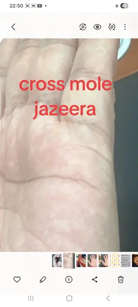 cross mole jazeera#sunline #palmreader #palmistry #