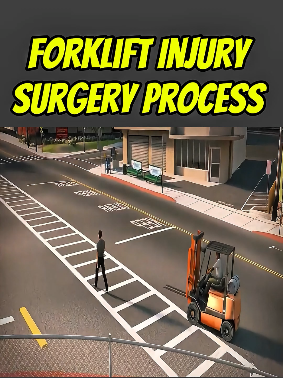 Forklift accident injury medical surgery 3d animation #surgery #legs #medical #animation #awareness 