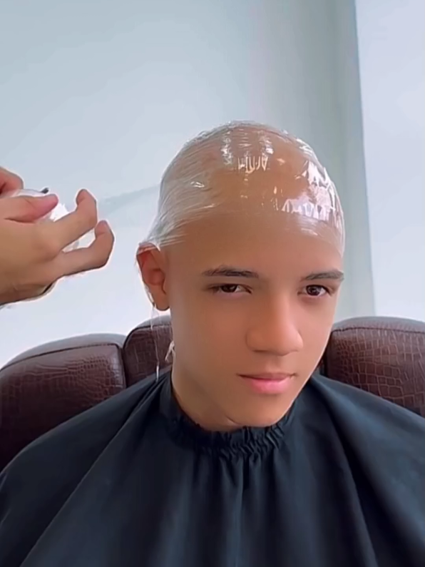 Hair Transplant | hair transplant transformation | #hairtransplant #hair_transplant Barber Hair Cutting videos | Best Haircut | Hairdresser Videos | Hair Stylist Of TikTok | Barbers Cut | do hair with me as a hairstylist | Haircut transformation | Barber Transformation | Hair Tutorial Layered Hair | Locks Transformation | Hair Stylist | Barber Hair Cut | Combover | hair content creator | Barber near me | classic haircut | Hair Cut Layers | clean haircut | Hair treatment Recommendations | super layered haircut | hairtiktok | Haircut videos | What To Ask Your Hairstylist For | hair for hair | tape haircut | how to style wigs for beginners | wayv haircut | haircut recommendation | Best Hair Clippers | Hair Videos | Hair Care & Styling | Beauty content | Before and after haircut | self haircuts | Haircut trend | box cut haircut | before after hair transformation | if I cut hair once am i a barber | aguero reaction man city vs madrid | hair trend tutorial | Tapperfade Haircuts | self hair cut | aesthetic haircuts boys | modern haircut | haircut tips | Haircut as | Best Barber Clippers | Medium Haircut salon | haircut | hair before after | Hair Salons | barber shop | haircuts | Trying Different Hairstyles | tip | haircut  #Barber_Hair_Cutting_videos #Best_Haircut  #Hairdresser_Videos  #Hair_Stylist_Of_TikTok  #Barbers_Cut  #do_hair_with_me_as_a_hairstylist  #Haircut_transformation  #Barber_Transformation  #Hair_Tutorial_Layered_Hair  #Locks_Transformation #Hair_Stylist  #Barber_Hair_Cut  #Combover  #hair_content_creator  #Barber_near_me  #classic_haircut  #Haircut_Layers  #clean_haircut  #Hair_treatment_Recommendations  #super_layered_haircut  #hairtiktok  #Haircut_videos  #What_To_Ask_Your_Hairstylist_For  #hair_for_hair  #tape_haircut  #how_to_style_wigs_for_beginners  #wayv_haircut  #haircut_recommendation #Best_Hair_Clippers #Hair_Videos  #Hair_care_and_styling  #Beauty_content  #Before_and_after_haircut #self_haircuts  #Haircut_trend  #box_cut_haircut  #before_after_hair_transformation  #if_I_cut_hair_once_am_i_a_barber  #aguero_reaction_man_city_vs_madrid #hair_trend_tutorial  #Tapperfade_haircuts  #self_hair_cut  #aesthetic_haircuts_boys  #modern_haircut  #haircut_tips  #haircut_as  #Best_barber_clippers  #Medium_haircut  #salon_haircut  #hair_before_after  #Hair_salons  #barber_shop_haircuts  #Trying_different_hairstyles  #tip_haircut 