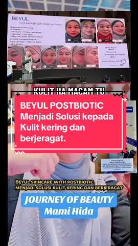 #tiktoklive #jeragat #kulitkering #beyulpostbiotics #hydratedskin 