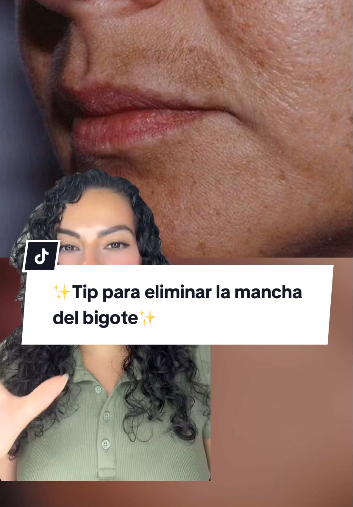 ✨Tip para eliminar la mancha del bigote✨ y recuerden que los resultados dependen del tipo de piel y la constancia en el uso del producto.  #darkspots #koreanskincare #antiagingskincare #tiktokshopcreatorpicks #koreanskincareproducts @celimax US Store 