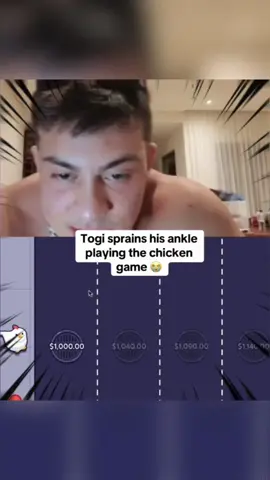 togi sprains his ankle playing the chicken game 😭 