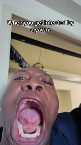 Skit Comedy about a yawn #fyp #comedy #skit #fypシ 