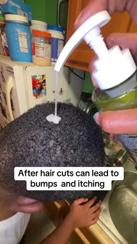 Brmud has been help me with my skincare Now with hair care and the problem I face with taking son to these barbers. To razors bumps and itching #brmud #tiktokshoprestock #superbrandclub #hairgrowth #razorbumps 