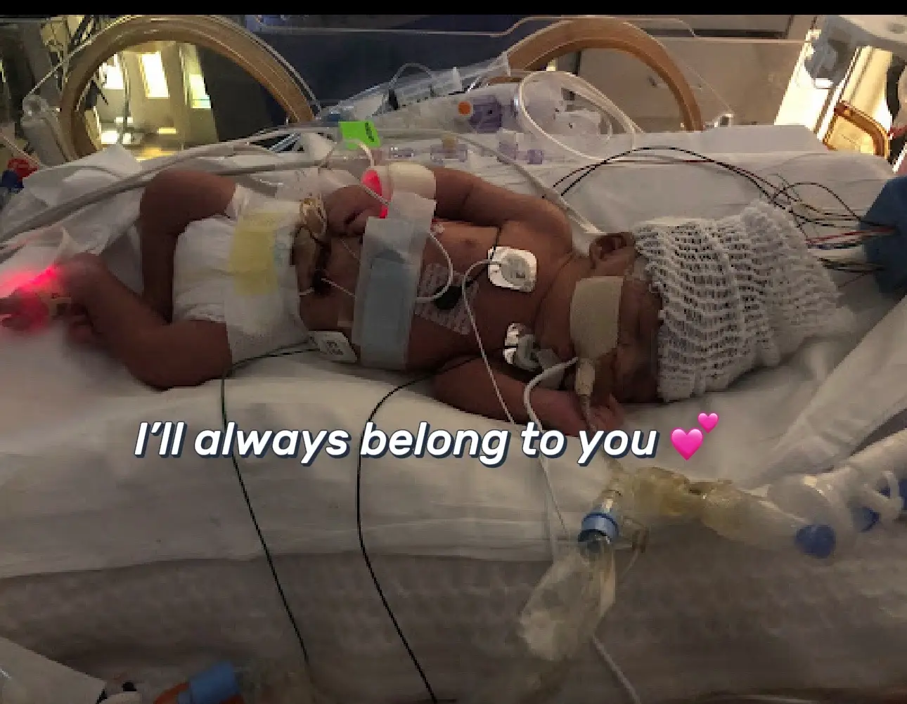 My heart will always belong to you❤️  #trending #fyp #viral #braininjury #tiktokmom 
