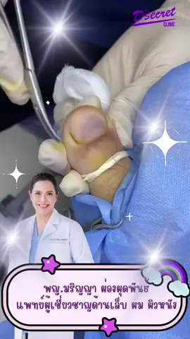 เล็บขบกับหมอเกตุ@Dr Kate @Sevenplus clinic #รักษาเล็บขบ #เล็บขบ #ตัดเล็บขบมียาชา #เล็บขบอักเสบ #หมอเกตุมริญญา 
