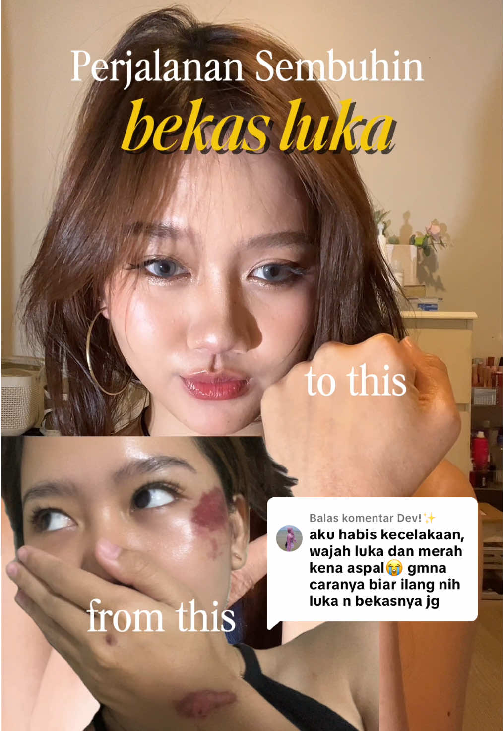 Membalas @Dev!✨ emang sesusah itu sih, cuma harus tau banget kandungan yang pas untuk hilanginnya, yap salah satunya AHA dan niacinamide kaya yang aku pakai ini 🥹✨#bodytonermr #cerahinsiku #bodytonermr 