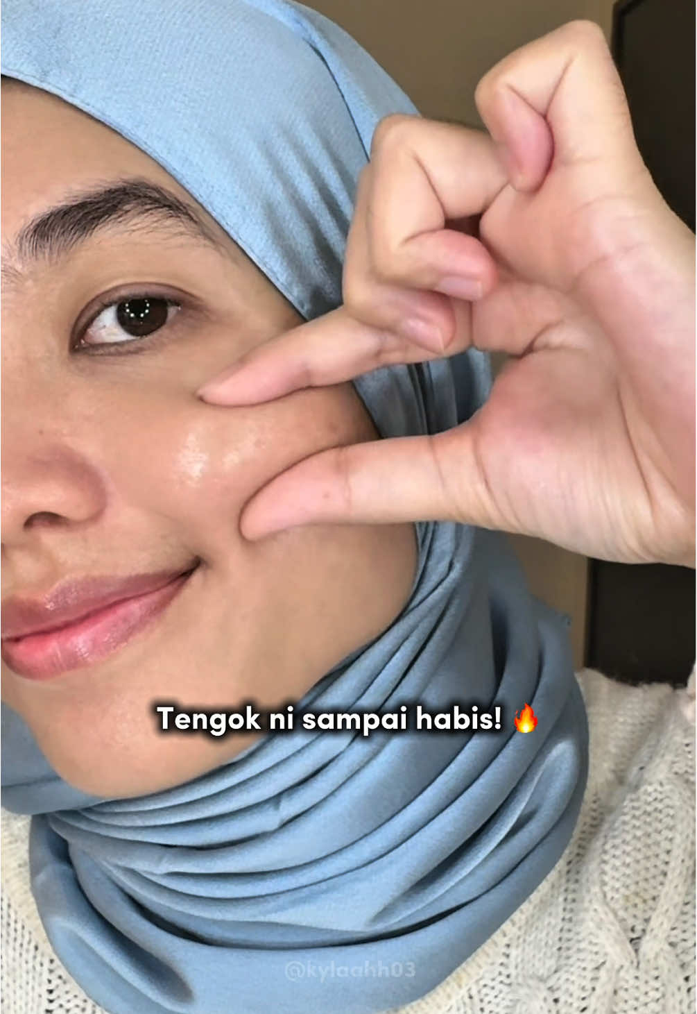 From dry & irritated ➡️ calm & glowing ✨ My go-to soothing balm from La Roche-Posay Cicaplast Baume B5!  ✔️ Hydrates dry & flaky skin ✔️ Soothes redness & irritation ✔️ Safe for sensitive skin + even baby rash 👶 Trust me, this one’s a lifesaver!🤍 @La Roche-Posay Malaysia #larocheposay #larocheposayskincare #skincarefordryskin #skincareroutine #cicaplastbaumeb5 