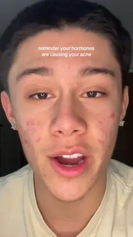 Runnnnn results may vary #skincare #acne 