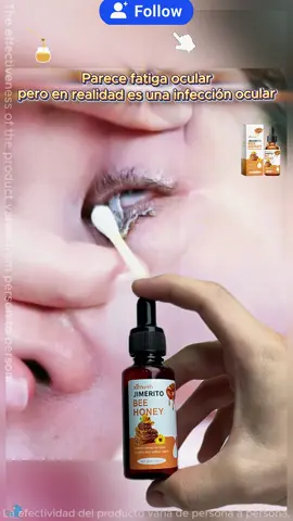 Jimerito Honey For Eyes, Refreshing, Moisturizing And Soothing Eye Drops For Dry And Astringent Eyes#honey #eyehealth #tiktokshopblackfriday #tiktokshopcybermonday #eyedrops 
