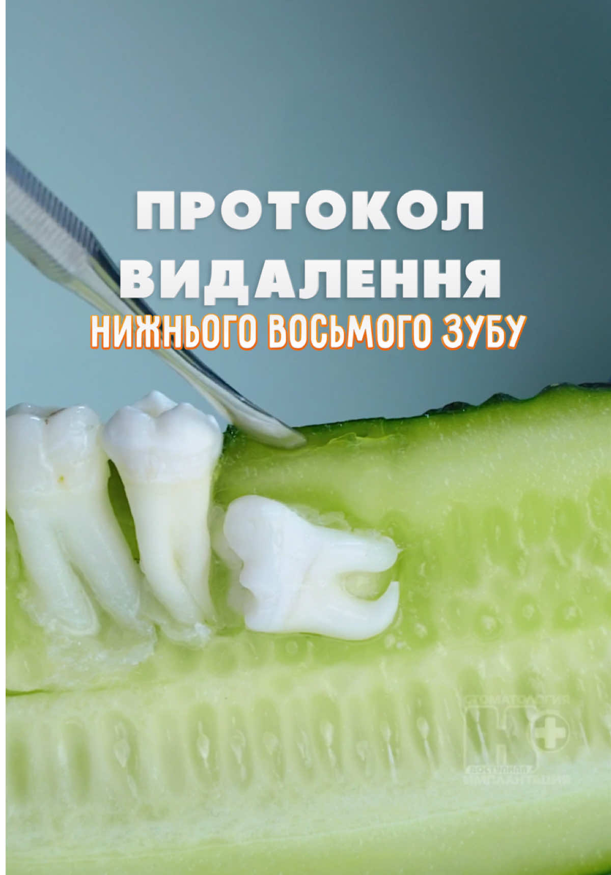 #стоматолог #стоматологДніпро #стоматологія #імплантаціязубів #вініри  