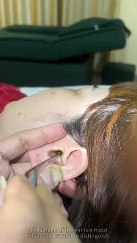 If qyou're not using these, START😅 c ear waxremovalw tool with camera earcleaning#earwax #eardrum #earwaxremovaltool#tiktokshopdeals #tiktokshopfinds#tiktokshoploveatfirstfind