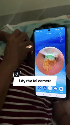 Cây lấy ráy tai camera #xuhuong #xuhuongtiktok #caylayraytai #caylayraytaigancamera #layraytaicocamera 