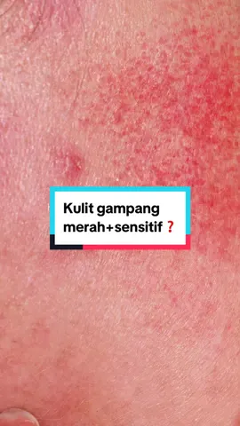 Cobain deh Pink Glowy Serum. engga lengket, gampang meresap dan tanpa alkohol jadi aman digunakan dari umur 12 tahun loh😍🫶🏻 #glowingbarengkymmskin #PromoGuncang99 #kymmskinofficial #oppakymm #belilokal 