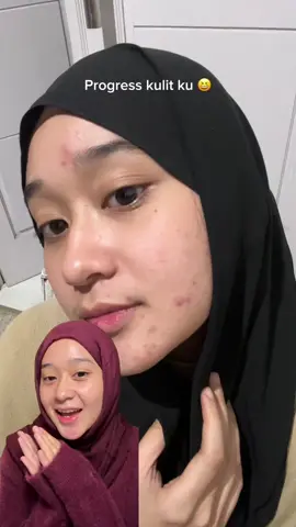 Jujur kalo liat kondisi muka dulu kaya ga nyangka bisa di titik iniii 🥺🫶🏻