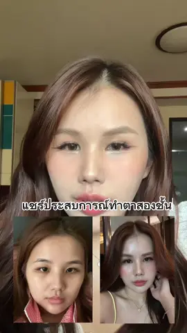 ว่าด้วยเรื่องทำตา มาแชร์เผื่อจะเป็นไอเดียให้สาวที่อยากทำตานะคะ ฟิลเม้ามอยๆๆ 😂 #ศัลยกรรมตา #ทําตาสองชั้น #รีวิวทําตา2ชั้น 
