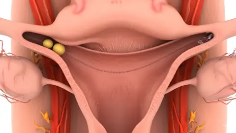 ‎Twins Baby inside view in Mother  #anatomy #viral #foryou#human#healthylifestyle