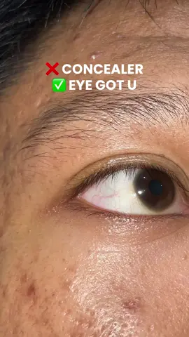 we love this eye got u bc of its benefits!! #eyegotu #simplyhueph #eyeserum #eyecare 