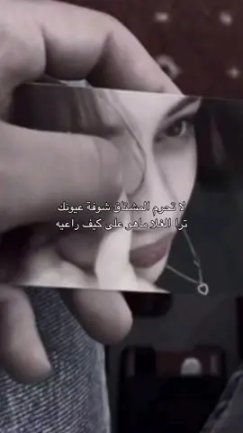 لاتحرم المشتاق نضرة عيونك 💔👨🏼‍🦯‍➡️❤️‍🩹👨🏻‍🦯