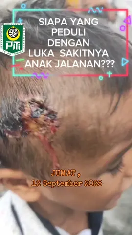 masih adakah hak mereka yang lapar???#dermawan #sedekah #sedekahseru #sedekahjumat #sosial 
