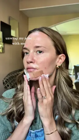 “dOn’T tOuCh YoUr AcNe”  #acnejourney #cysticacne #pimplepopping #acneproneskin #acnetreatment 