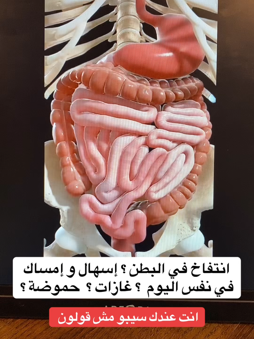 #قولون_تقرحي #إمساك_مزمن #قولون_معدة_غازات_إنتفاخات_إمساك_حموضة #قولون_هضمي #توعية_صحية #السعودية_الكويت #إنتفاخ_البطن #إنتفاخ_القولون #مكة_المكرمة_السعودية #إنتفاخ_البطن_والأمعاء #الرياض_الان #إمساك #قولون #الرياض_الآن🇸🇦🇸🇦 #الرياض_جده_مكه_الدمام_المدينه