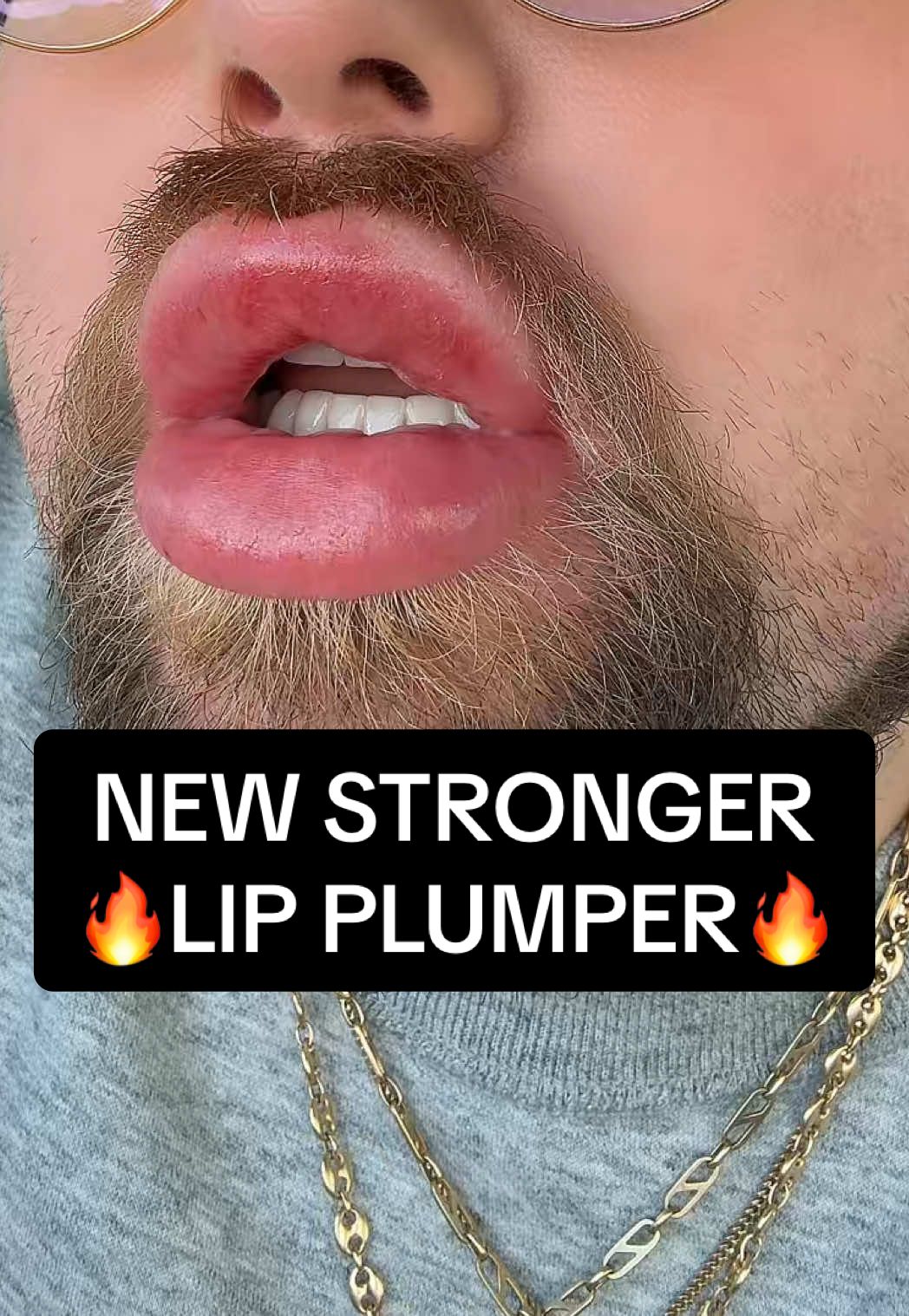 RUN.. this is THE ONE! 🔥👄 #lipplumper #reedleshot #lipgloss #biglips #lipplumperreview 