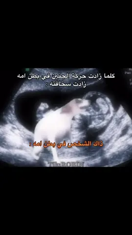 من الإكسبلور ؟ فولو الله يسعدك 🤍🫡#fyp #رياكشنات #رياكشنات_روبن 