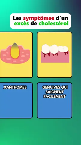 Tu as trop de cholestérol ? Les signes qui ne mentent pas ⚠️ #sante #cholesterol #nutrition #prevention #medecine