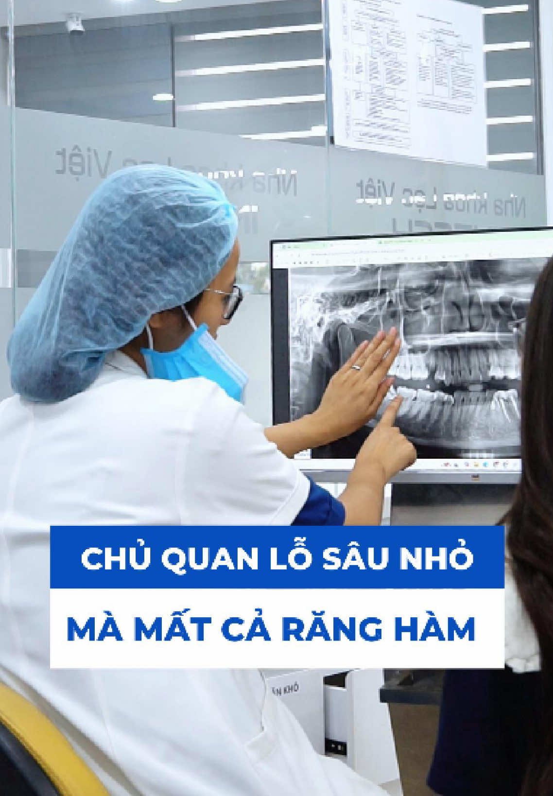 Răng khôn mọc nghiêng gây sâu răng 7!! Nếu có dấu hiệu sau cần đi kiểm tra ngay #lvit #lacvietintech #bacsithuanh #saurang #daurang 
