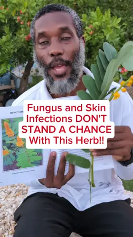 Have You Tried Cassia Alata For Fungus And Skin Infections? #CassiaAlata #RingwormBush #NaturalSkinCare #HerbalHealing #FungalRelief 