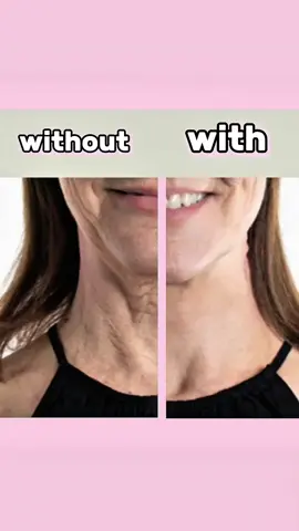 #necklift #saggyneckskin #instantnecklift #necklifttape #looseskin 