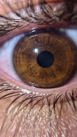 Ready eye #rowanmelody 
