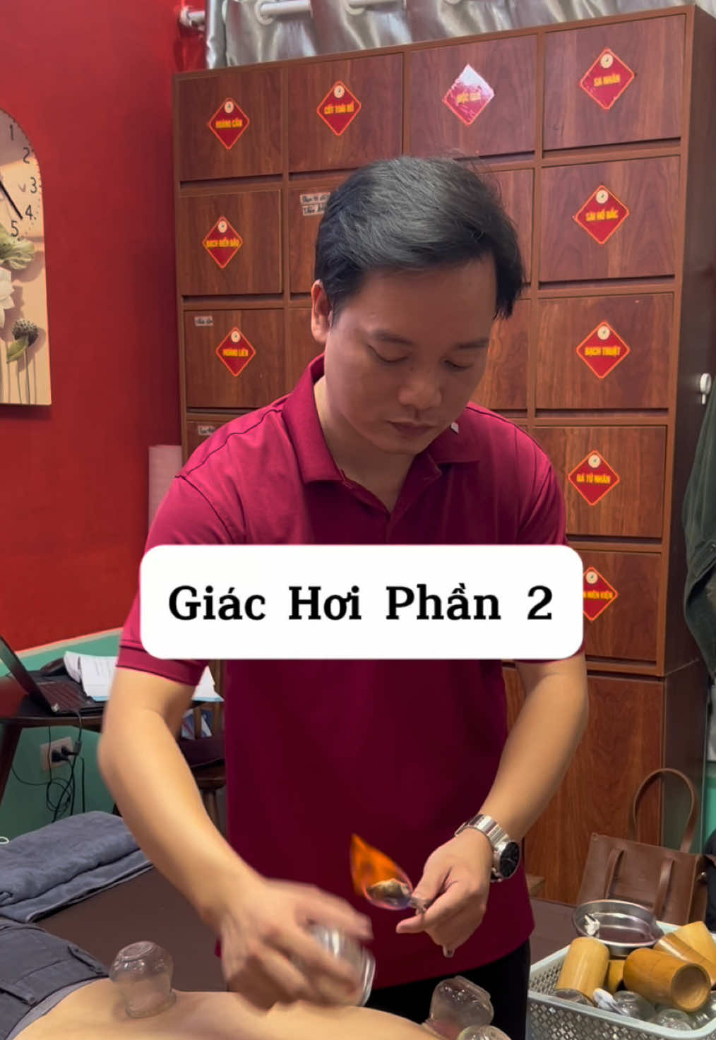 Giác Hơi - Phần 2  Hướng dẫn kĩ thuật #dongyhoanglienson #vutm #hocycogivui👩🏻‍⚕️💙 #giachoi #bacsichamcuu 