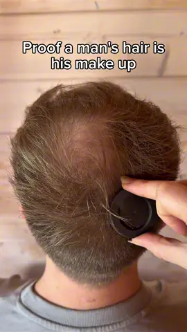 We all have something a man over 30 needs this! 