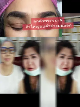 ลูกค้าพระราม 9 ลบคิ้วให้เล็กลง #ลบคิ้วล้างคิ้วแก้คิ้วอาจารย์วิสมุทรสาคร #รีวิวรอยแผลลบคิ้วอาจารย์วิสมุทรสาคร #ลบรอยสักช่างเอสมุทรสาคร #ลบคิ้วล้างคิ้วอาจารย์วิ #สักยันต์อาจารย์วิสมุทรสาคร 