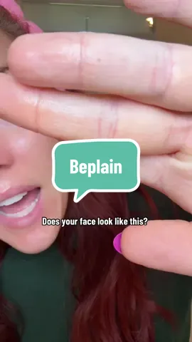 Skin that looks like this? The filter trio will be your best friend #beplain #beplaincleanser #doublecleansing #kbeauty #cloggedpores @beplain.shop @beplain 비플레인 