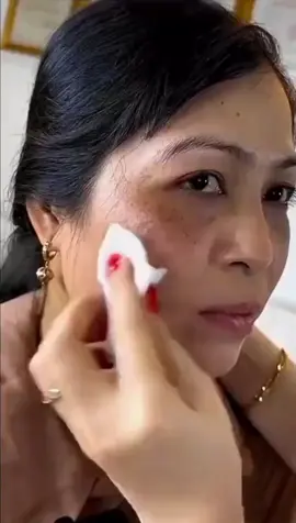 Get Rid of pigmentation dark spots remove pack at home #skincare #GlowUp #whitening #facemask #homeremedy 