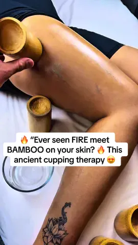 🔥 “Ever seen FIRE meet BAMBOO on your skin? 🔥 This ancient cupping therapy isn’t just a massage—it’s a full-body reset! Imagine melting tension, pulling toxins, igniting circulation, and awakening your energy flow all in one fiery ritual. 🔥🎋✨ People say it feels like stress is literally being burned away while your muscles soften like butter. 🧘‍♂️💨 Would you dare to try the FIRE BAMBOO CUPPING experience? ⚡🔥”#FireBambooCupping #BambooCupping #FireCupping #AncientHealing #holistictherapy 