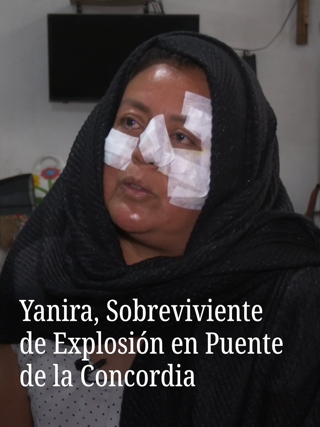 Yanira González es una de las sobrevivientes de la explosión de una pipa de gas en el Puente de la Concordia, en Iztapalapa. La profesora denuncia falta de regulación a las pipas de gas que circulan por Ciudad de México. #CDMX #Iztapalapa #puentedelaconcordia