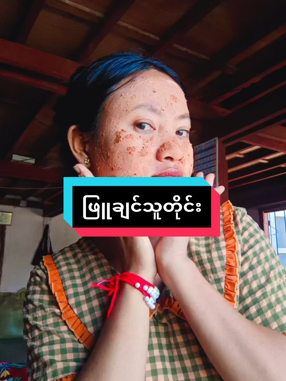 #ဘိုက်ဘာဖုန်း၀၉၆၉၈၉၁၀၁၀၁ #အာမခံတင်းတိပ်ပျောက်ဆေး🥑🥑 #တောင်ကြီးမြို့အကြီးဆုံးကိုယ်စားလှယ် #အမဲစက်အမာရွတ်အရှင်းပျောက် #တင်းတိပ်ပျောက်ချင်မှသုံး✅ 