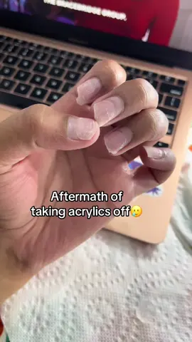 Works WONDERS!! #nailgrowthoil #nailtok #nailstrengthener #nails #damagednailsrepair 