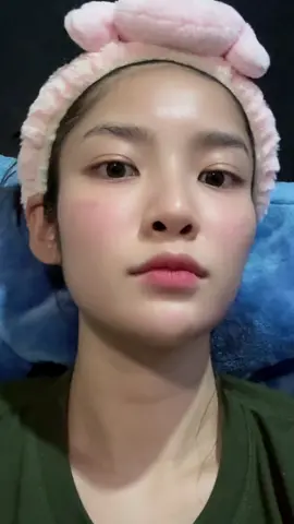 จึ้งใจมาก รู้งี้ไปฉีดนานละ!! @TheRoyalClinic  #ฟิลเลอร์ #ฟิลเลอร์ปากกระจับ #ฟิลเลอร์แท้ #ฟิลเลอร์ปรับรูปหน้า 