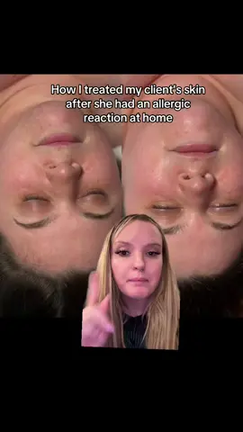 @Circadia does it again 🥰 calls are available at the link in my bio if you want to learn how to navigate these situations with your own clients. #esthetician #soloesthetician #estheticianlife #estheticianschool #estheticiantiktok 