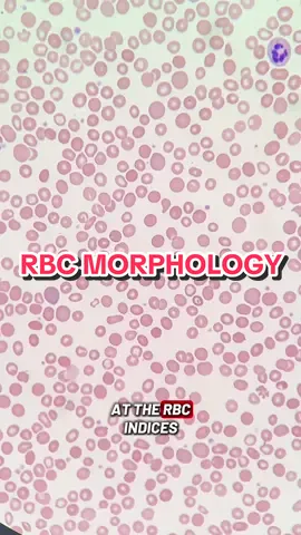 Red blood cell morphology! Keep in mind that smear reviews can be subjective and may vary a bit from tech to tech. The important thing is noticing the presence or absence of the abnormal morphologies.  #medtechtok #hematology #clinicallaboratoryscientist 