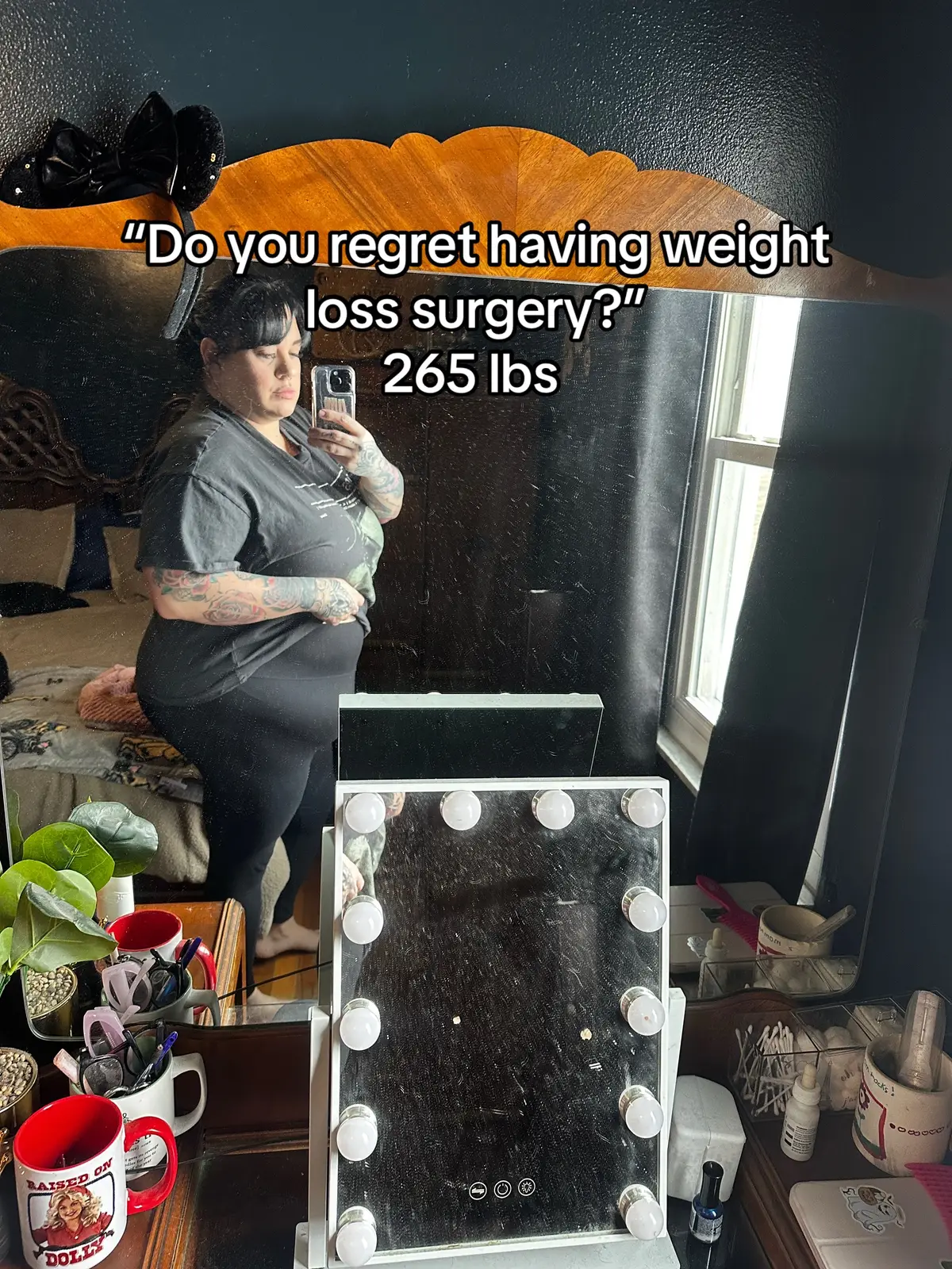 #vsg #vsgcommunity #weightloss 