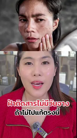 #ฝ้าติดสาร #ฝ้ากระจุดด่างดําจางลง #Lucen  #ลูเซน #ดูแลฝ้าติดสาร 